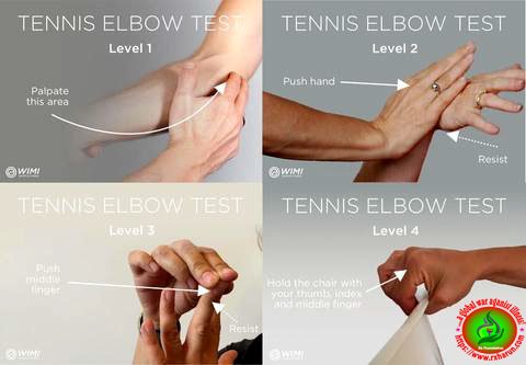 tennis-elbow