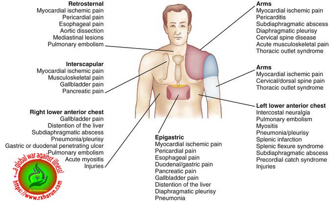 Angina Pectoris- Causes, Symptoms