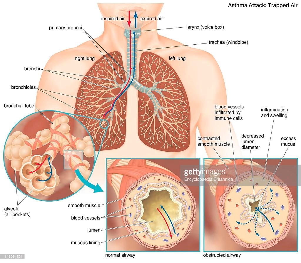 Asthma Latest Researchl