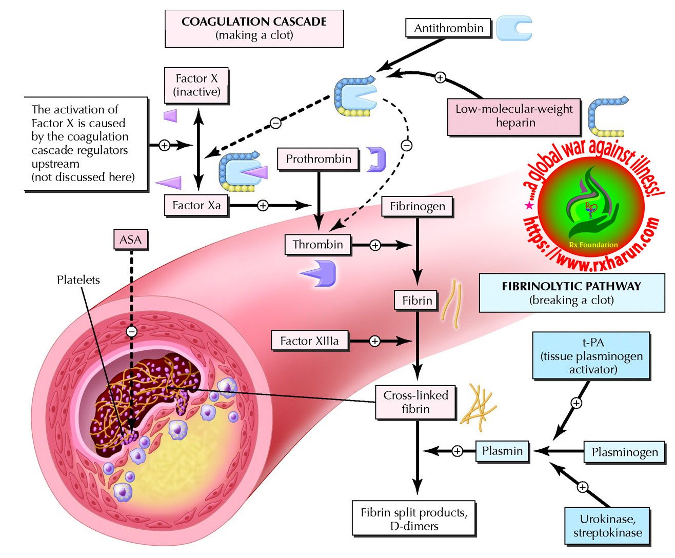 Myocardial Infarction Causes Symptoms Diagnosis Treatment Rx Harun