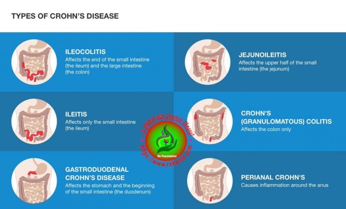 Rxharun |.....a global war against illness!!!