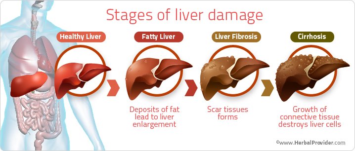 Fatty Changes in Liver