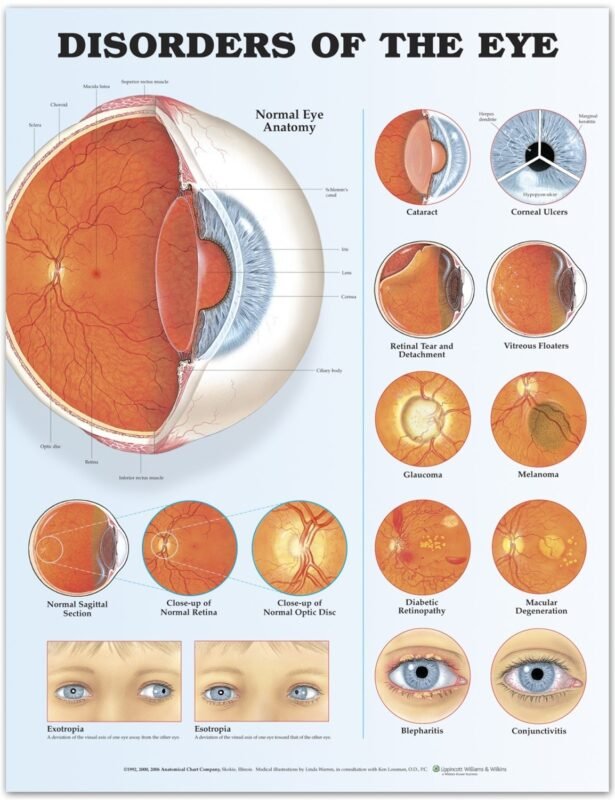 Hyperopia Causes