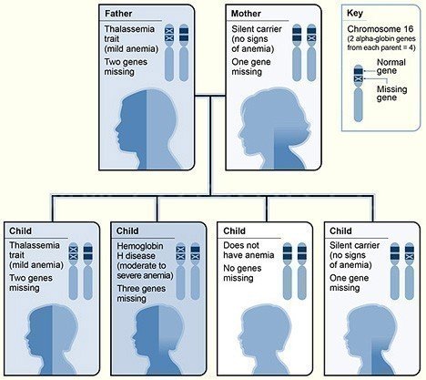 Thalassemia