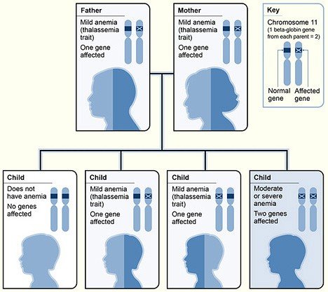 Thalassemia