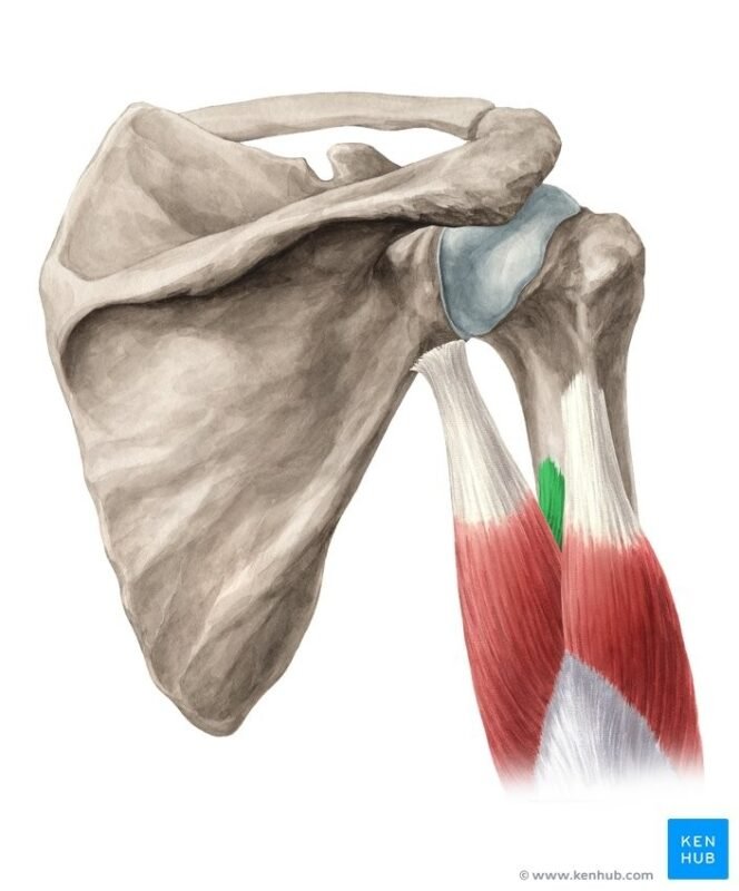 Causes Symptoms of Triceps Tendinitis