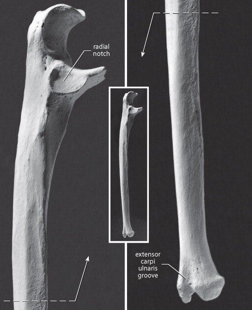 Muscles Attachment of Ulna