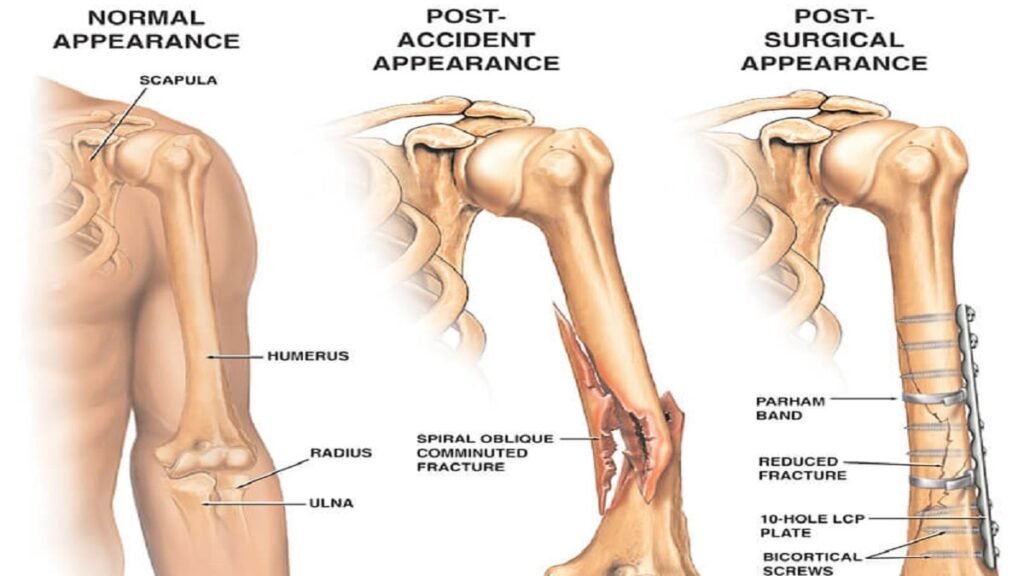 Functions of Humerus
