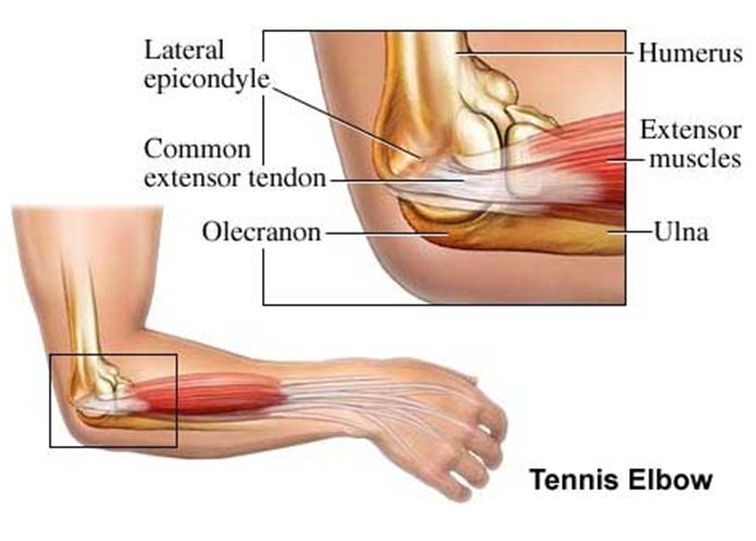 Elbow Injuries