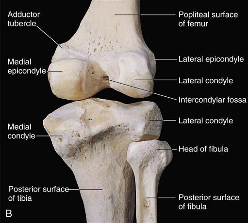 Knee Dislocation