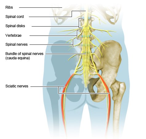 C7 and T1 Disc Herniation