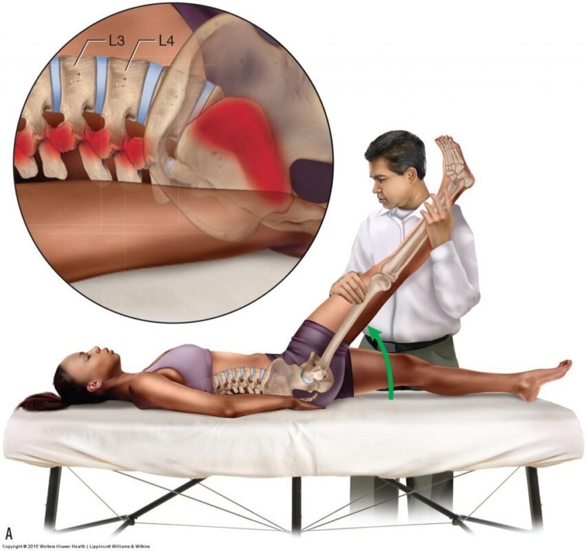 Lasegue sign/Straight Leg Raising Test (SLRT)