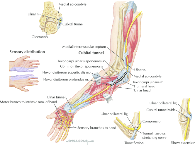 Median Nerve Neuropathy