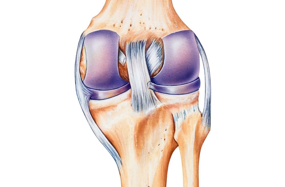 Крестообразные связки коленного сустава анатомия. Разрыв связок коленного сустава. Дегенеративные изменения крестообразных связок коленного сустава