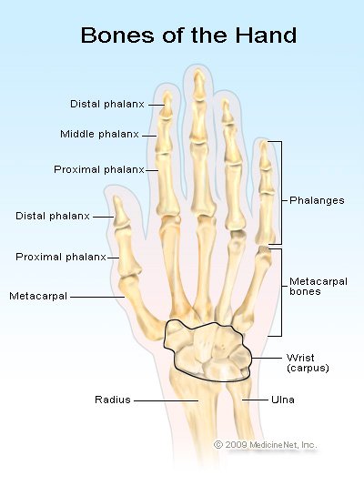 Metacarpal fractures