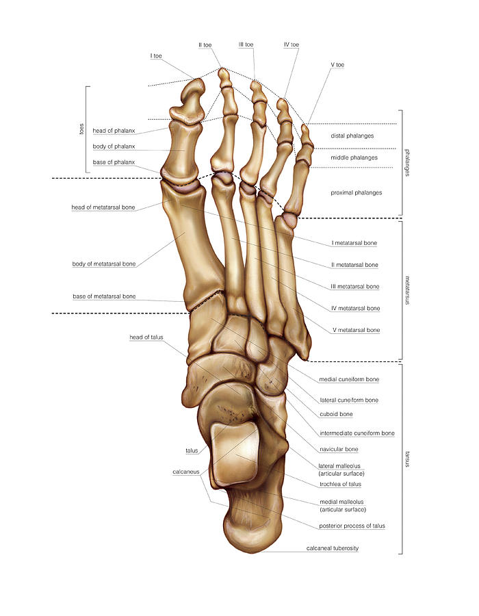 Talar Neck Fracture Talar Neck Fracture