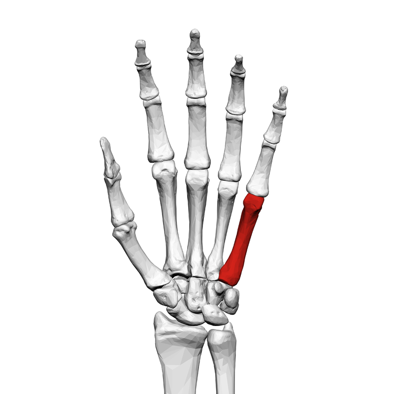 Fifth Metacarpal Base Fracture Fifth Metacarpal Base Fracture