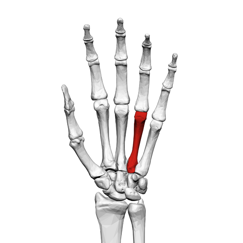Fourth Metacarpal Head Fracture