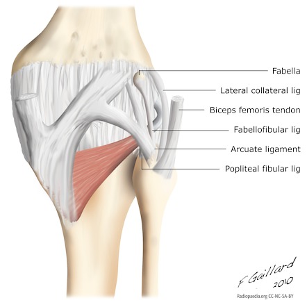 Arcuate Complex Avulsion Fracture (arcuate sign) Arcuate Complex Avulsion Fracture (arcuate sign)
