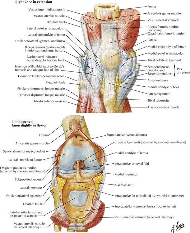 Metaphyseal-Diaphyseal Tibial Plateau Fracture Metaphyseal-Diaphyseal Tibial Plateau Fracture