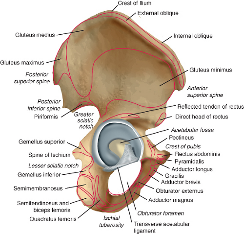 Acetabulum Fractures