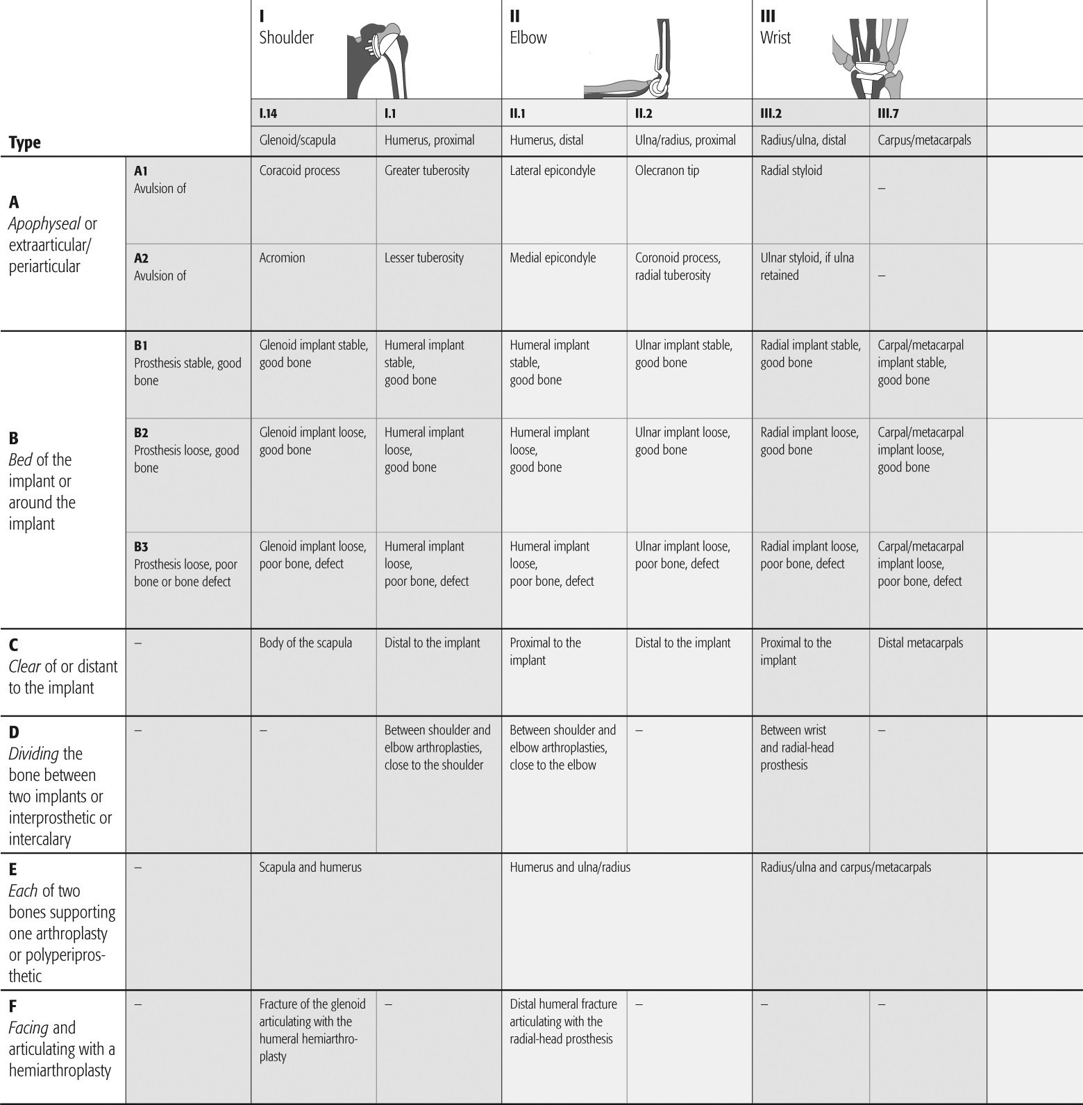American Academy of Orthopedic Surgeons Classification of Periprosthetic Hip Fractures American Academy of Orthopedic Surgeons Classification of Periprosthetic Hip Fractures