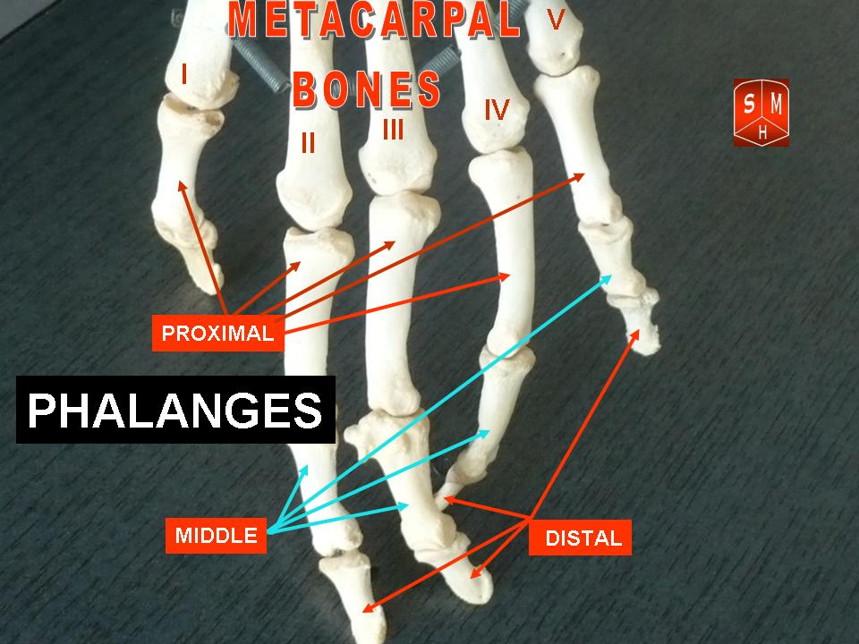 Phalangeal Neck Fractures