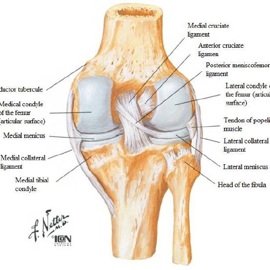 Metaphyseal-Diaphyseal Tibial Plateau Fracture Metaphyseal-Diaphyseal Tibial Plateau Fracture