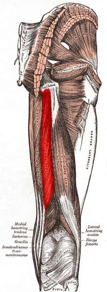 Semitendinosus Tendon Avulsion Fractures Semitendinosus Tendon Avulsion Fractures