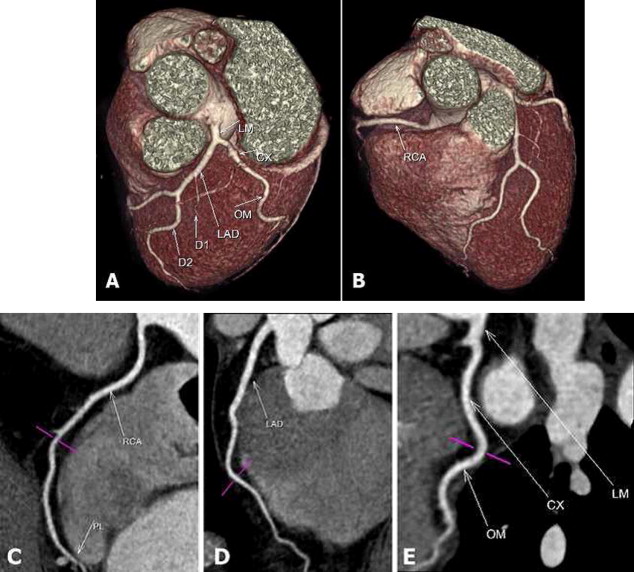 Multi-Slice Computed Tomography (MSCT)