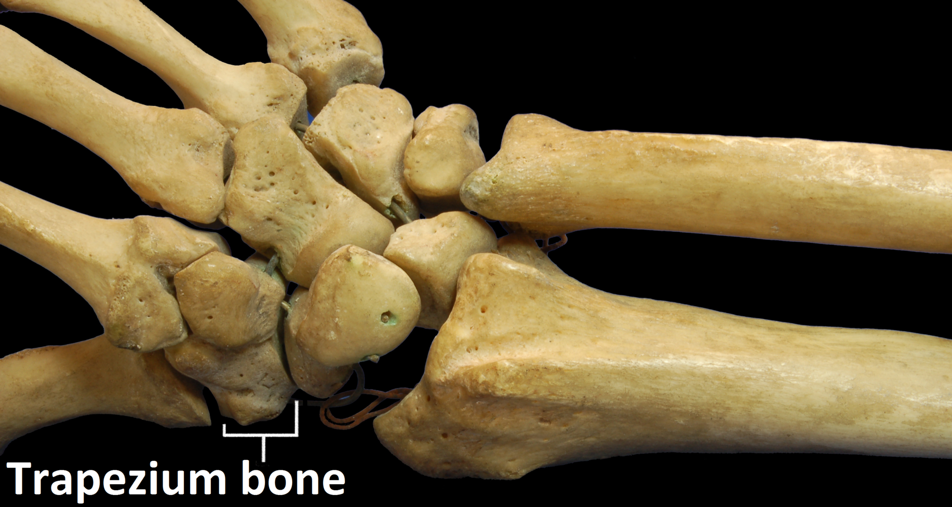 Carpal Bones Carpal Bones