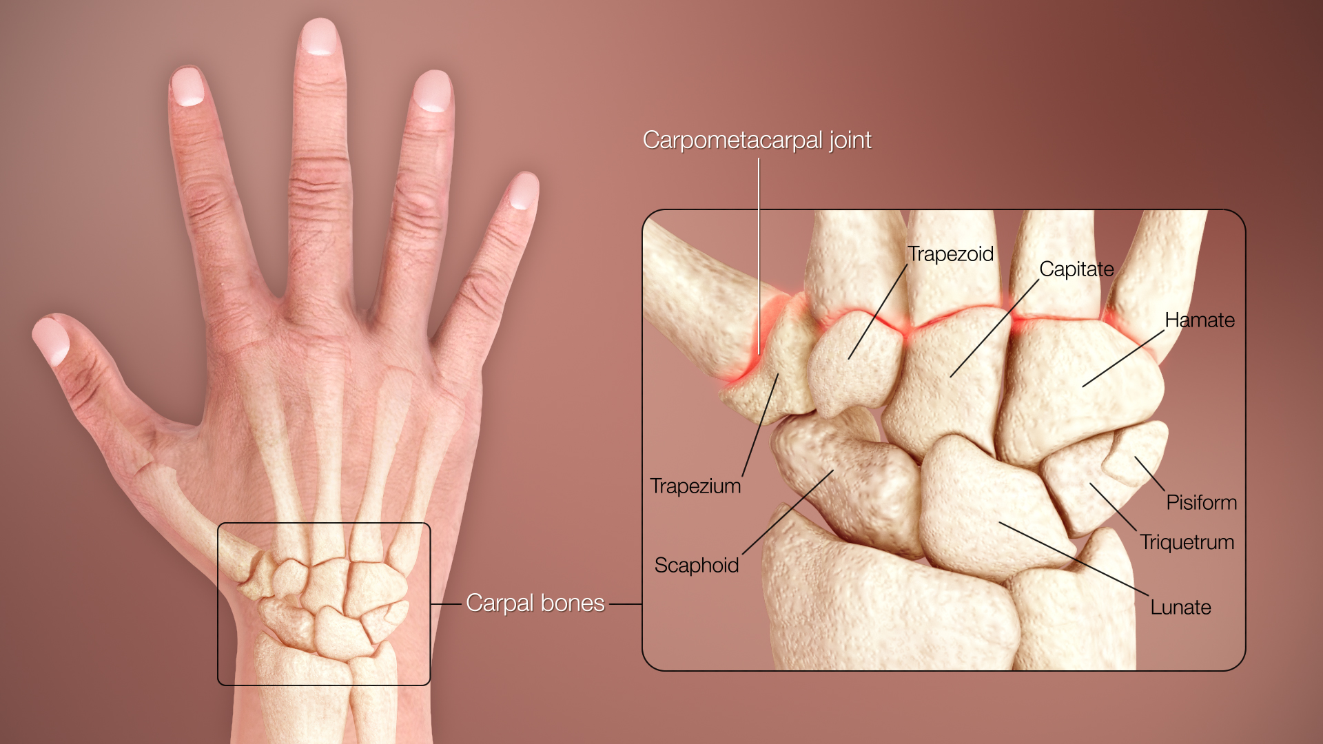 Carpal Bones Carpal Bones