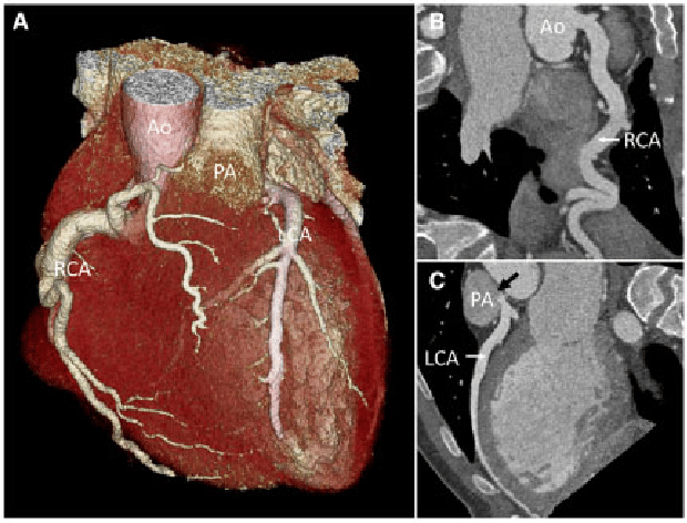 Multi-Slice Computed Tomography (MSCT)