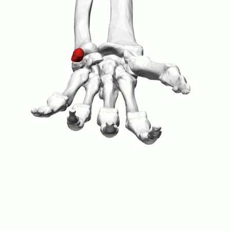 Carpal Bones
