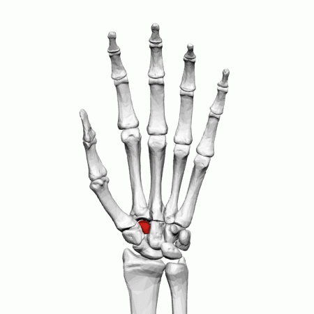 Trapezium Fracture