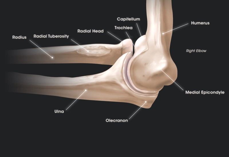 Lateral Humeral Condyle Fractures