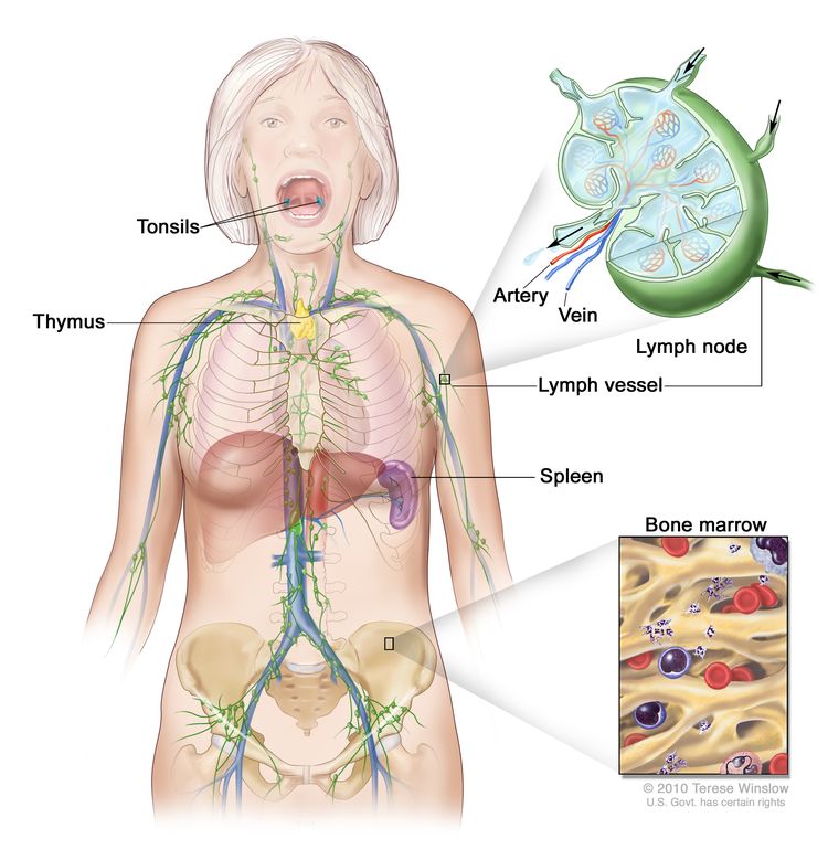 Lymphedema Lymphedema
