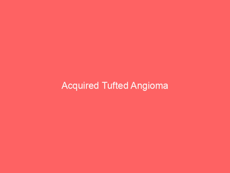 Acquired Tufted Angioma
