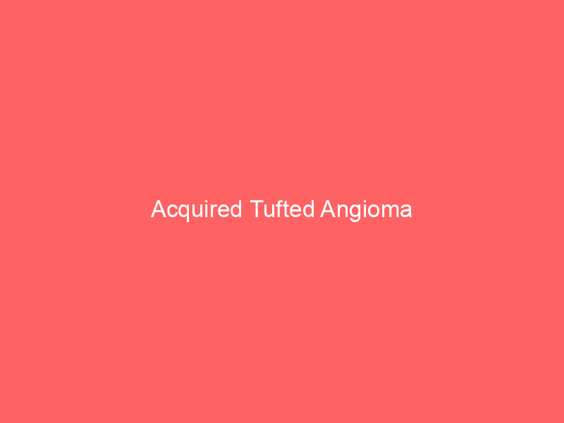 Acquired Tufted Angioma