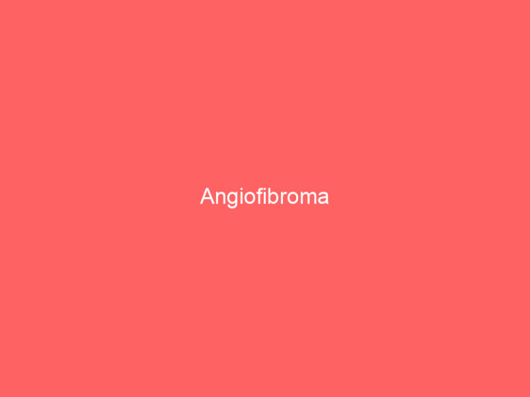 Angiofibroma