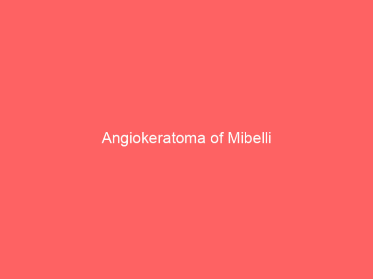 Angiokeratoma of Mibelli