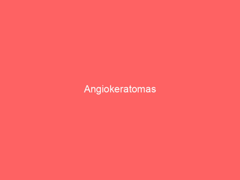 Angiokeratomas