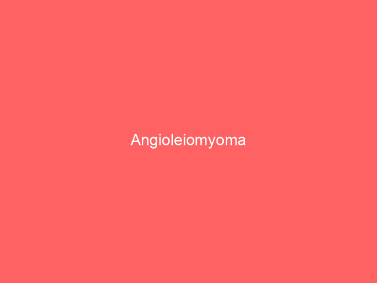 Angioleiomyoma
