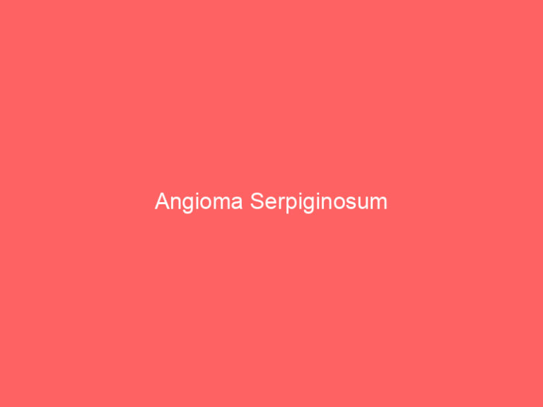 Angioma Serpiginosum