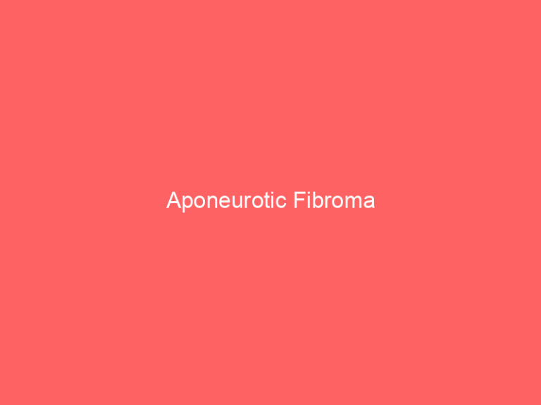 Aponeurotic Fibroma