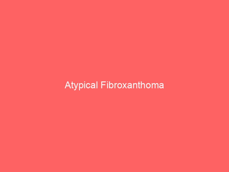Atypical Fibroxanthoma