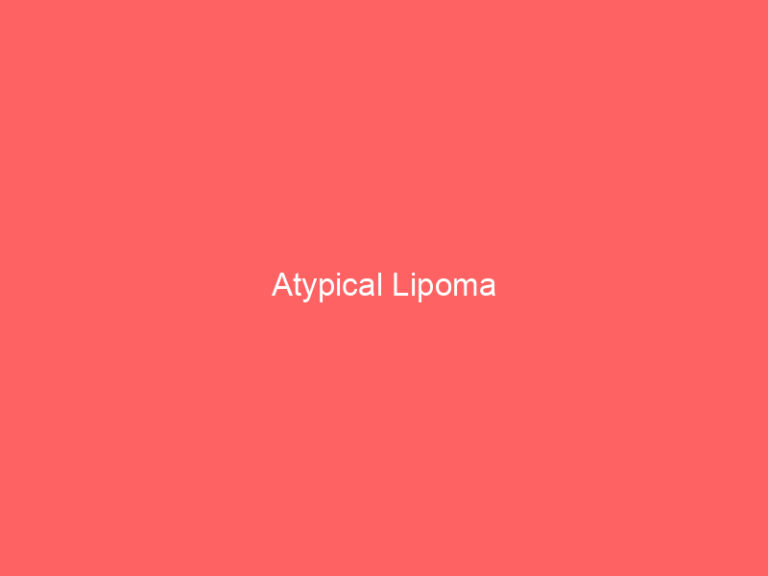 Atypical Lipoma