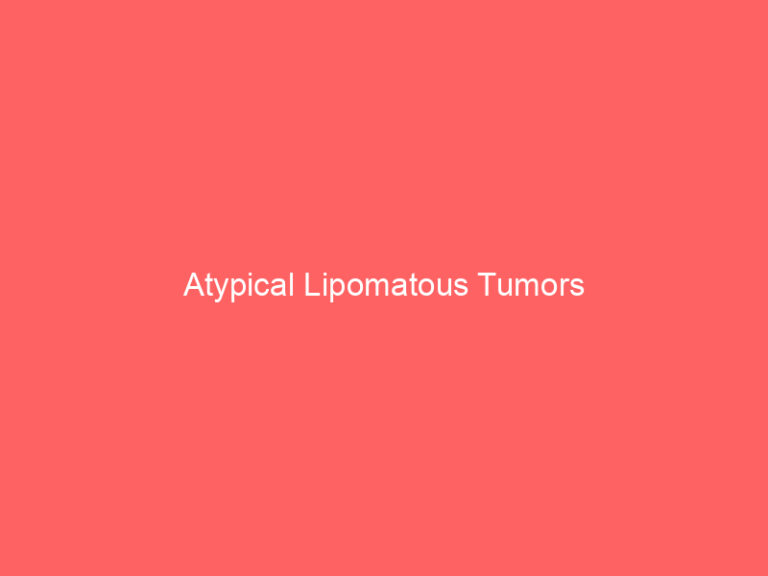 Atypical Lipomatous Tumors