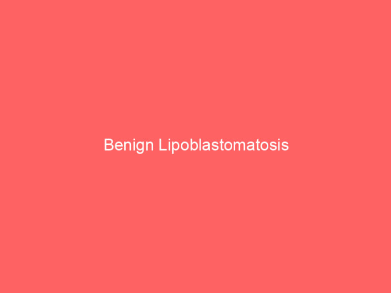 Benign Lipoblastomatosis