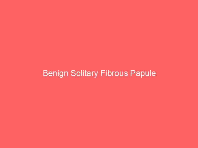 Benign Solitary Fibrous Papule